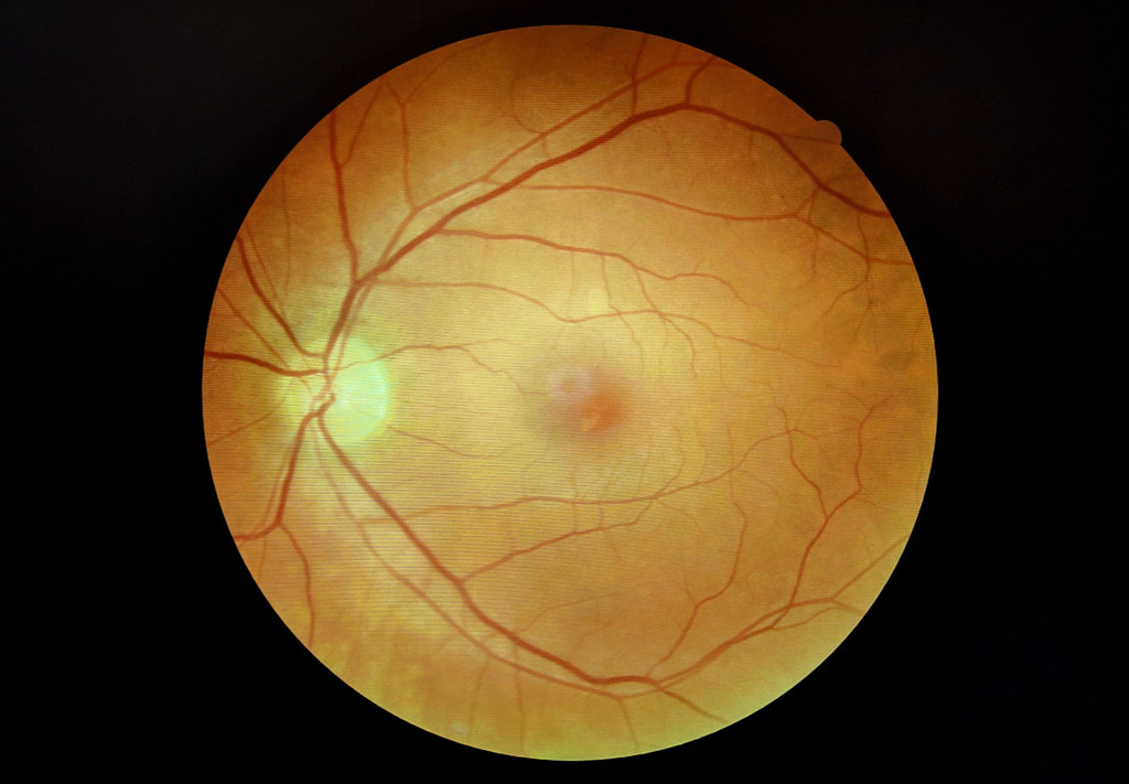 Retinal Scan Image