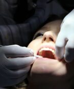 Teeth being treated b an oral hygeneist. Photo courtesy of the IPTC.